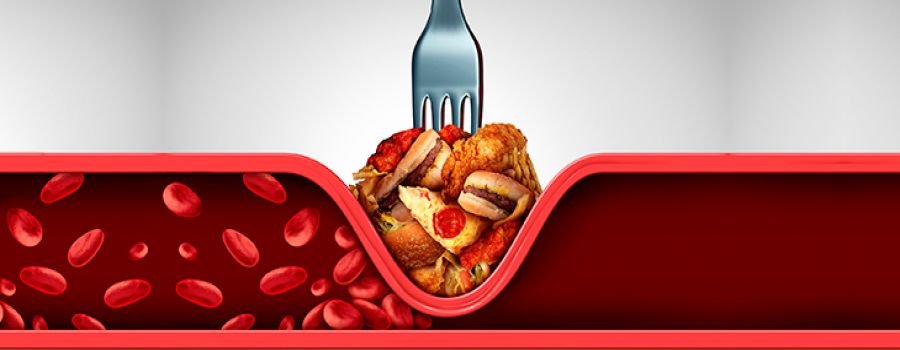 Qual o Papel da Dieta com Baixo Teor de Sódio no Controle da Pressão Arterial? 1