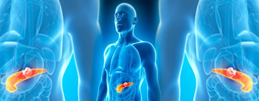 Microbioma Oral está Associado ao Câncer de Pâncreas 1